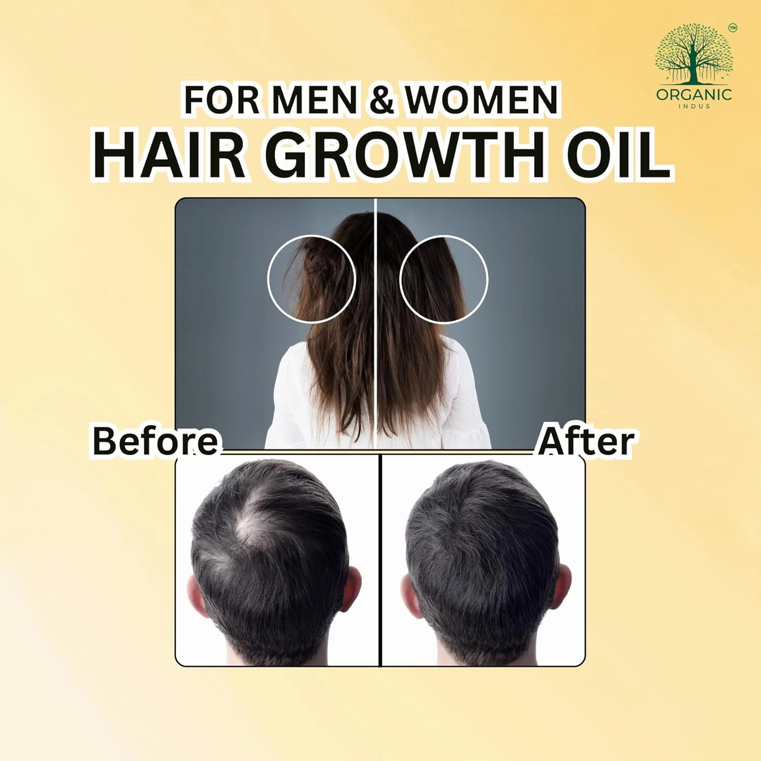 Batana Hair Oil for Hair Growth 2oz (60ml) | Infused with Jamaican Black Castor Oil | Thickening, Strengthening, Moisturizing, Hydrating for Dry Hair | Double Growth Formula