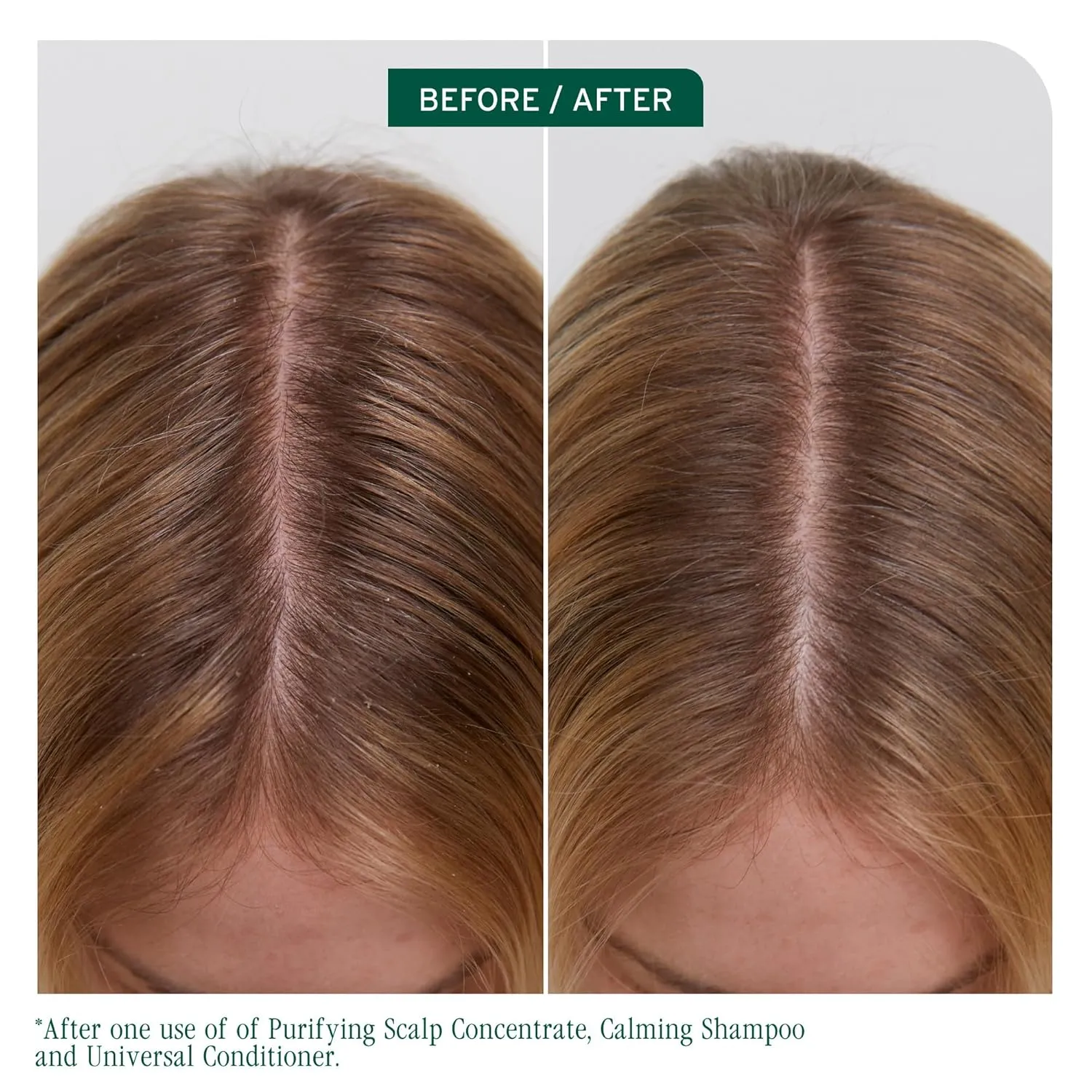 Biolage Scalp Sync Universal Conditioner - Nourishing & Hydrating for All Scalp Types, Lightweight Conditioning, Fermented Tea Blend & Glycolic Acid, Vegan & Paraben-Free, Packaging may vary
