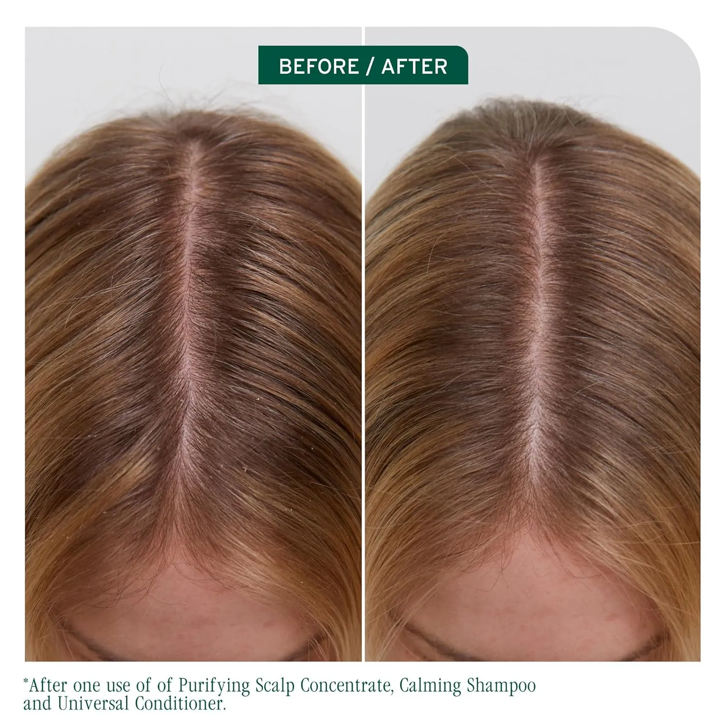 Biolage Scalp Sync Universal Conditioner - Nourishing & Hydrating for All Scalp Types, Lightweight Conditioning, Fermented Tea Blend & Glycolic Acid, Vegan & Paraben-Free, Packaging may vary