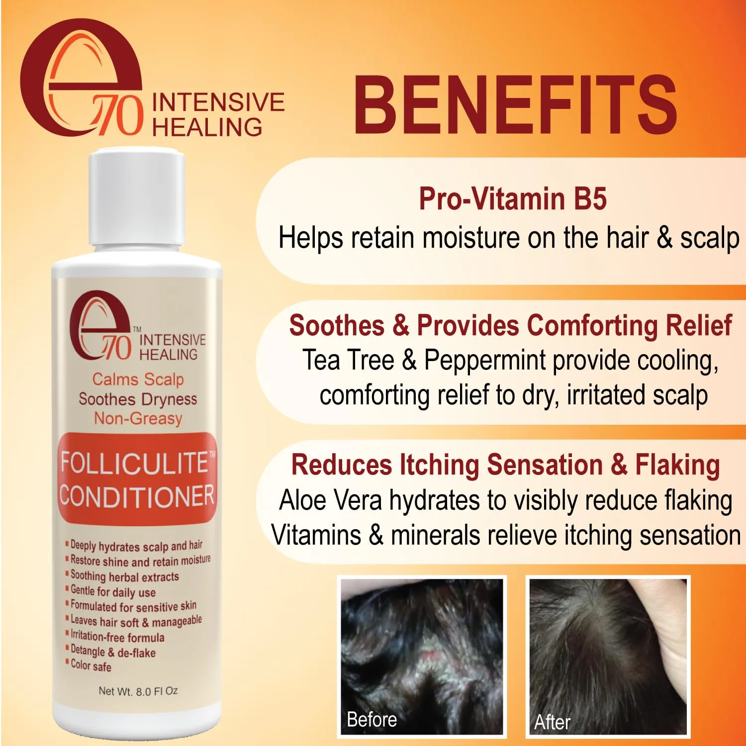 Folliculitis Treatment Hair Conditioner | Moisturize Sensitive Skin, Itchy, Dry Scalp & Damaged Hair Repair | Herbal Extracts for Soft, Shiny Hair | Gentle Color-Safe Detangling Solution