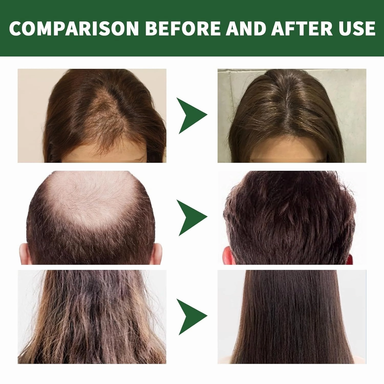 Ginger Hair Growth Conditioner Hair Regrowth Cream Moisturizing Scalp Massage Hair Follicle Hair Care