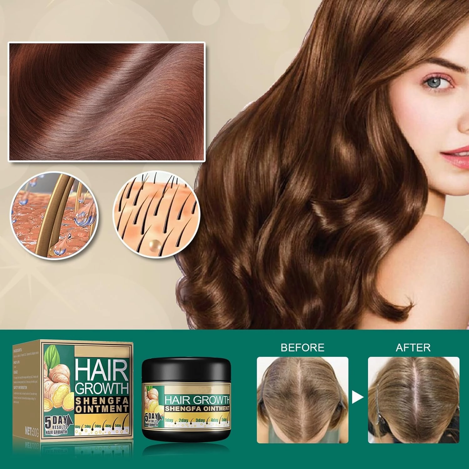 Ginger Hair Growth Ointment, Ginger Germinal Conditioner, Hair Regrowth Serum, Moisturizing Scalp Massage Hair Follicle Cream for Hair Loss & Thinning (5 Pack 30g/1 OZ)