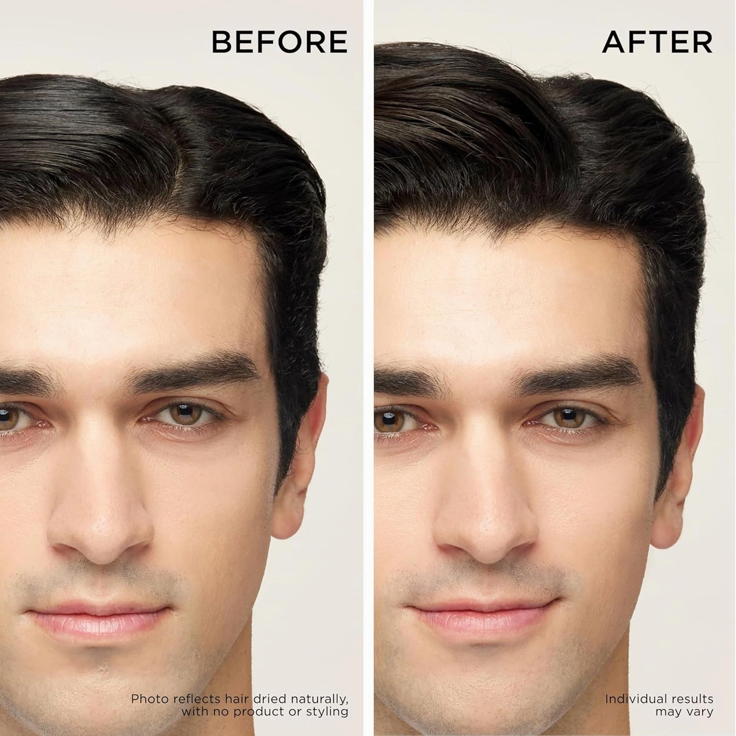 Hair Thickening Conditioner for Hair Loss and Thinning Hair, Korean Hair Care, Biotin Conditioner, Moisturizing, Strengthening, Color Safe