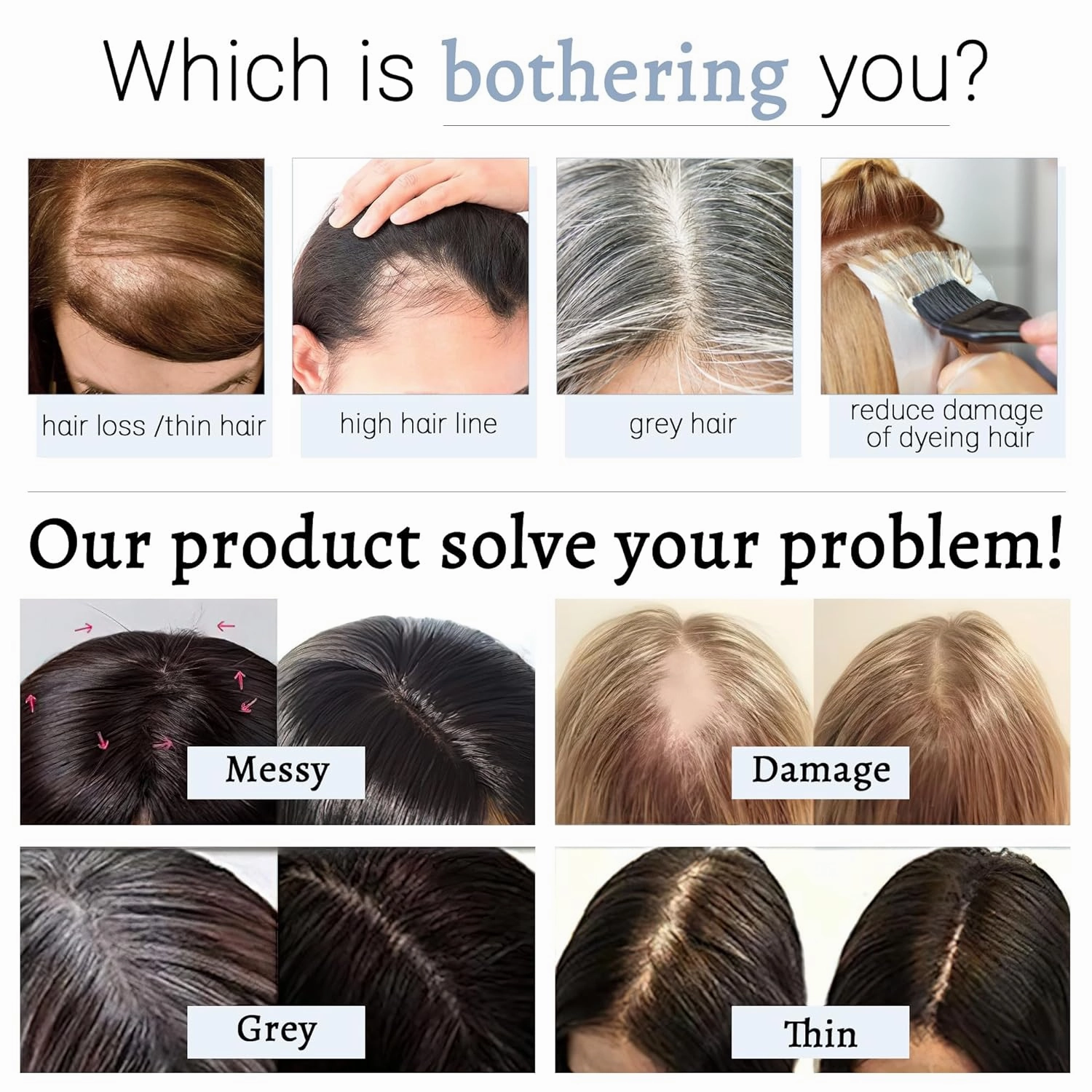Hair Toppers for Women Real Human Hair With Bangs 7 * 13 CM Silk Base Clip In Topper Hairpieces Wiglet Top Hair Pieces for Women With Thinning Hair -6 Inch Medium Brown