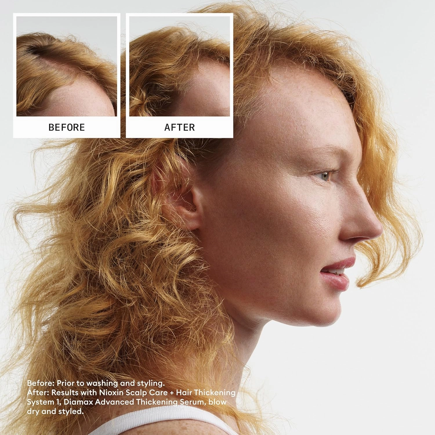 Nioxin System 1 Scalp   Hair Thickening Conditioner for Natural Hair with Light Thinning | Strengthen Against Breakage with Niacinamide & Biotin | Refreshed Scalp with Healthy Shine