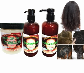 Organic Hair Solution-Kids Hair Growth Set- Pomade-Shampoo-Conditioner-Scalp & Hair Strengthening-For Stronger Longer Hair-Split Ends & Dry-Sulfate/Paraben Free- For All Hair Types (pack 3)