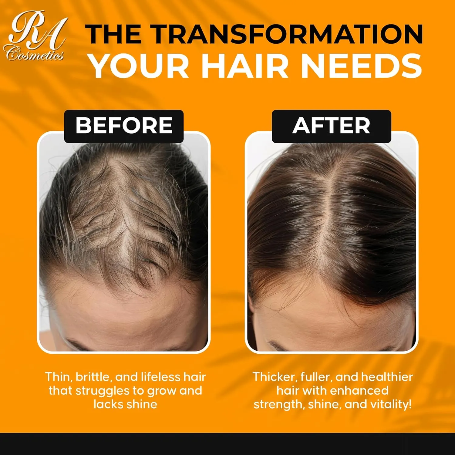 RA COSMETICS 100% Natural Unrefined Batana Hair Oil for Healthy Hair, 16 oz | Dr Sebi Batana Oil Hair Moisturizer for Damaged Hair Repair| Strengthening and Nourishing Hair Conditioner