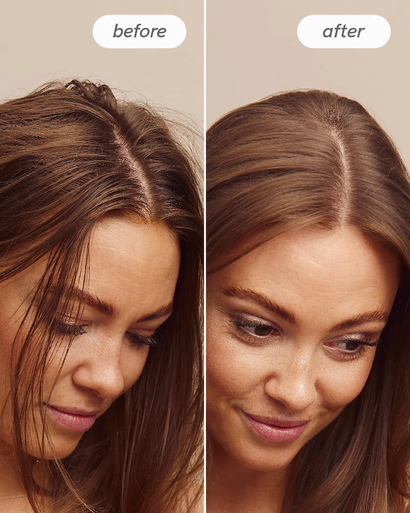 Scalp Delight™ Detox Scrub