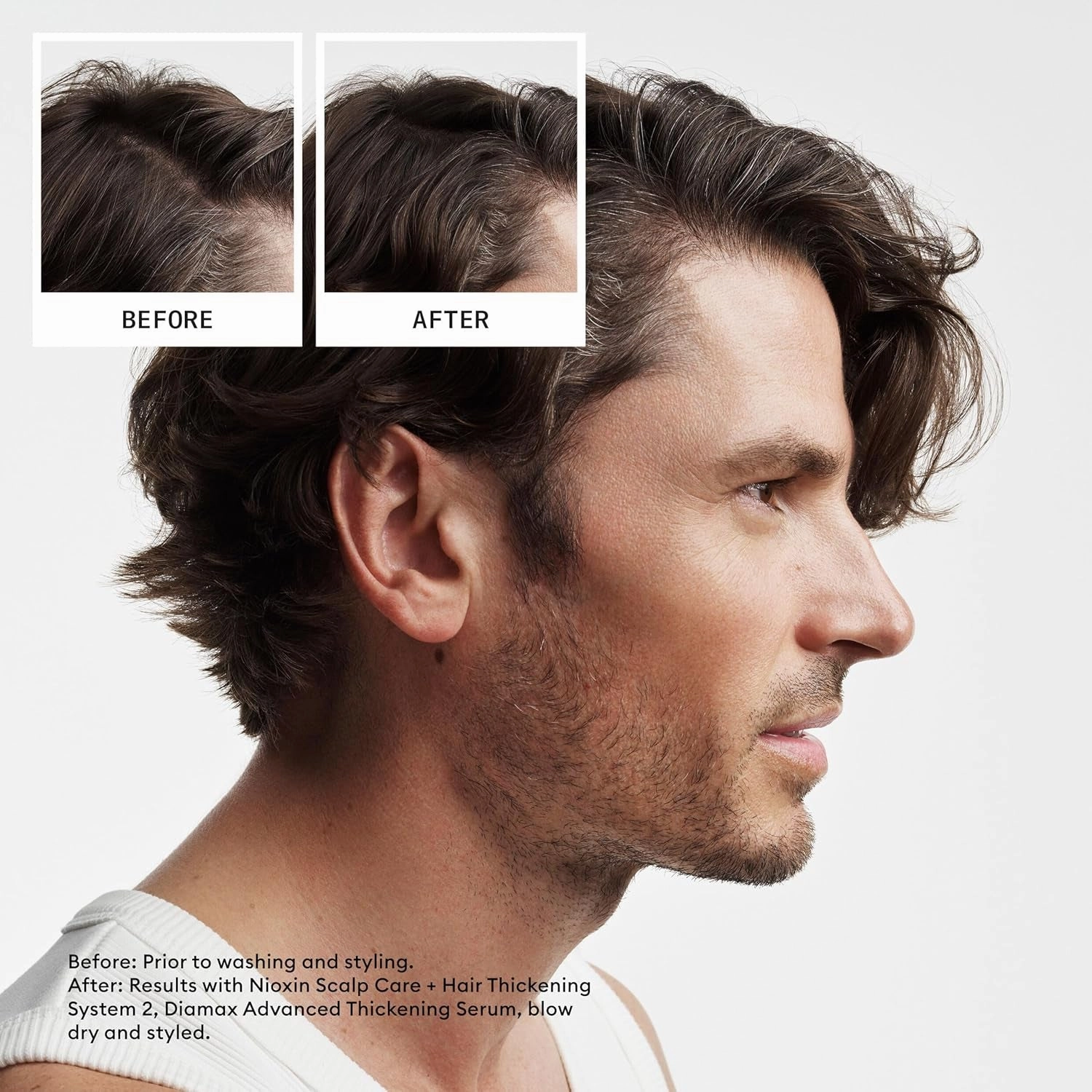 System 2 Scalp   Hair Thickening Conditioner, for Natural Hair with Progressed Thinning, Boost Hair Density with Niacinamide & Biotin